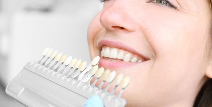 Отбеливание зубов – естественная красота без вреда