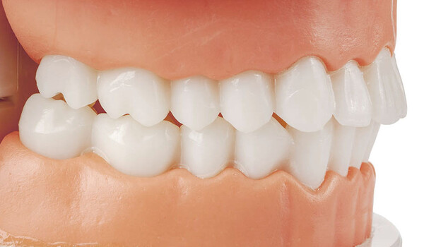 Какие бывают виды прикуса: классификация и лечение