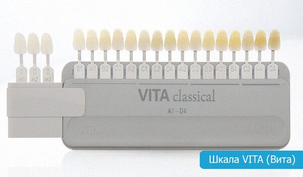Какого цвета выбрать виниры: ответ стоматолога