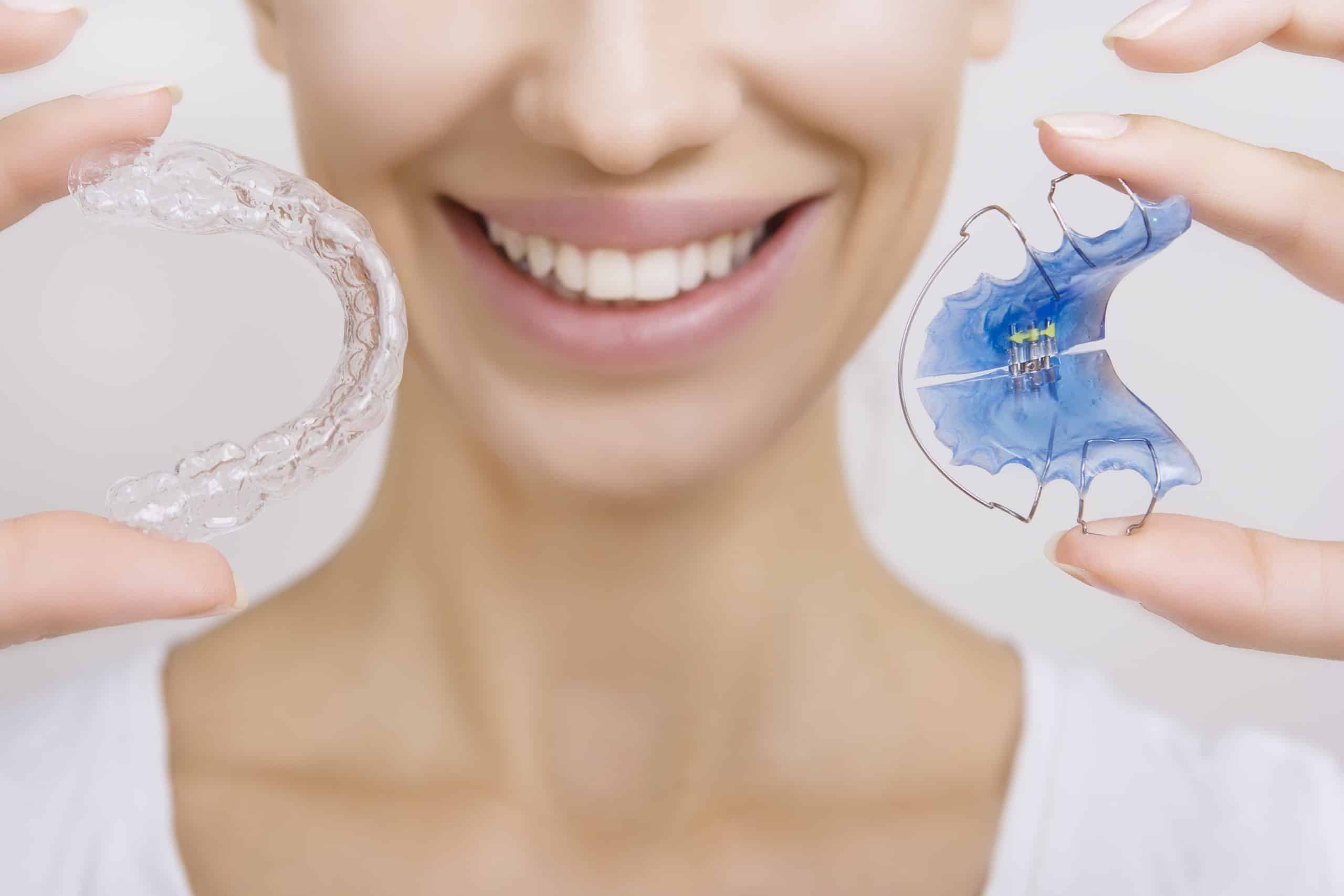 Ретейнеры и ретенционные каппы: для чего нужны и чем отличаются